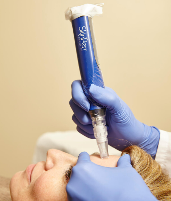 Skinpen microneedling procedure