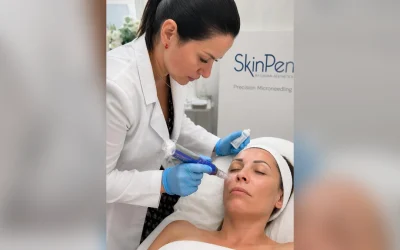 How Many SkinPen Sessions Do You Need After 40? Course and Maintenance Explained
